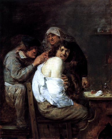  Adriaen Brouwer The Back Operation - Hand Painted Oil Painting